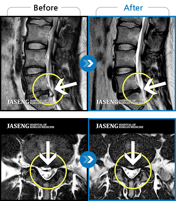 õڻѹ溴 ġ MRI  ġ-  ſ     6 㸮 к  ӵǾ  2  ߰ ݵǾ Ͽϴ.