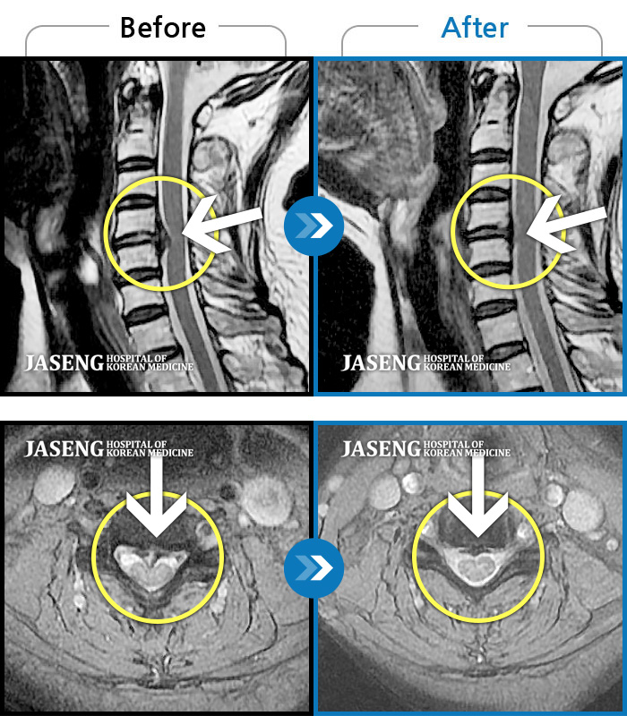 õڻѹ溴 ġ MRI  ġ-   īӰ .