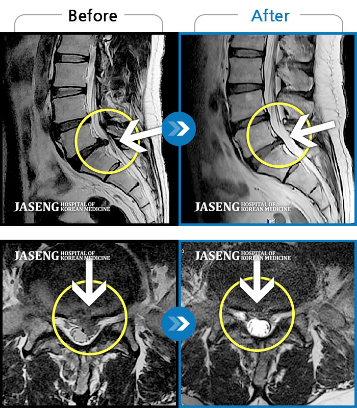 õڻѹ溴 ġ MRI  ġ- ڼ   ġ, , Ƹ ĸ, , ߰   . 