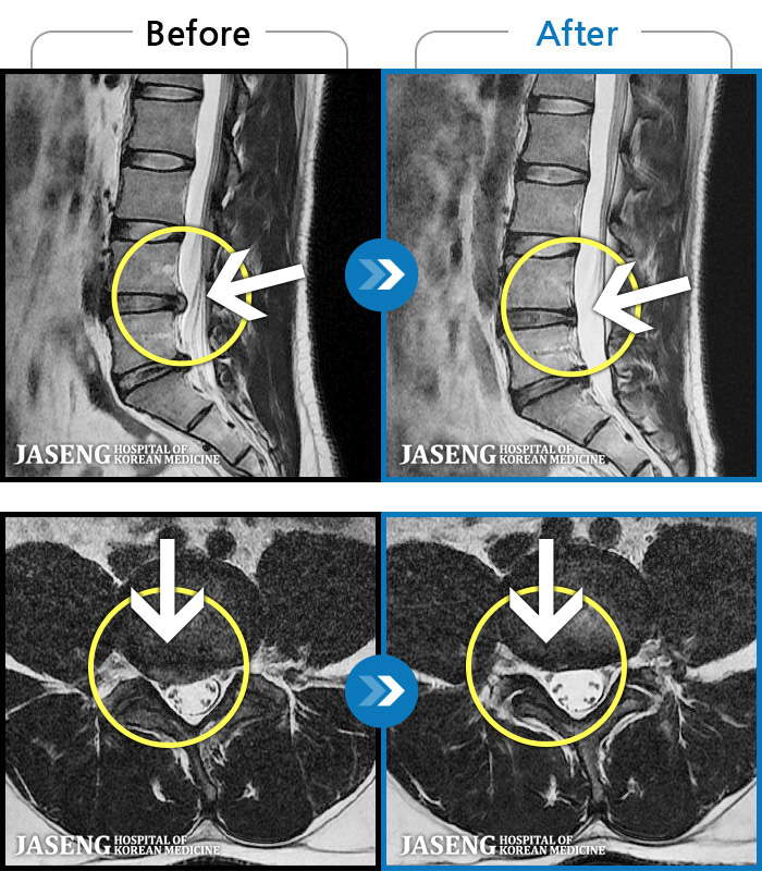 õڻѹ溴 ġ MRI  ġ- 㸮 㸮 ̸   ִ.