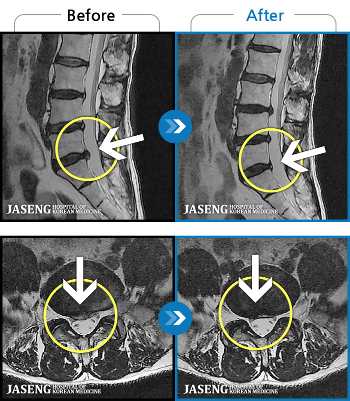 õڻѹ溴 ġ MRI  ġ-   ϰ     ӵǾϴ. ߰ Ͽ ߰   Ǵ  ߵ ̻  ȣϴ ¿ϴ.