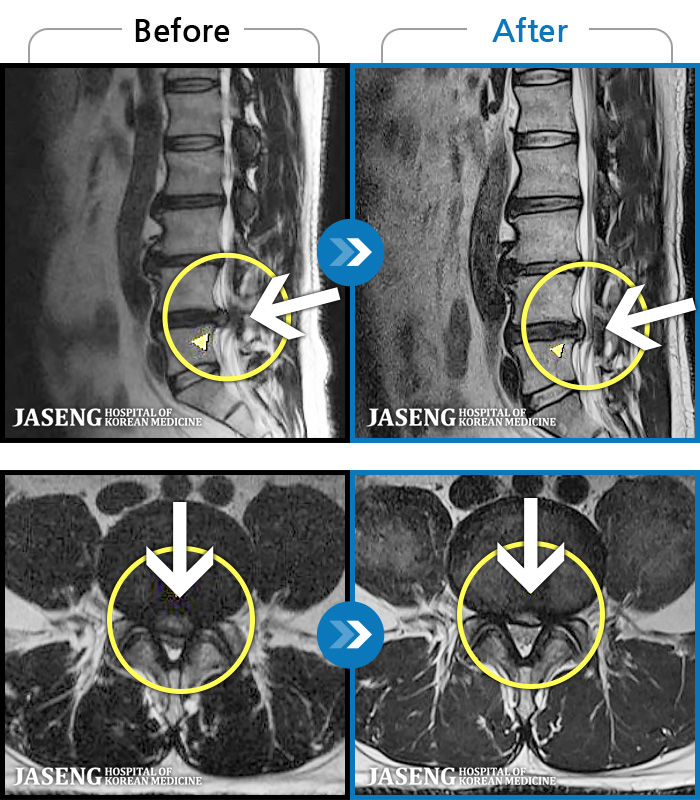 õڻѹ溴 ġ MRI  ġ-㸮  ϰ  ,   ̾   ϼ̽ϴ.