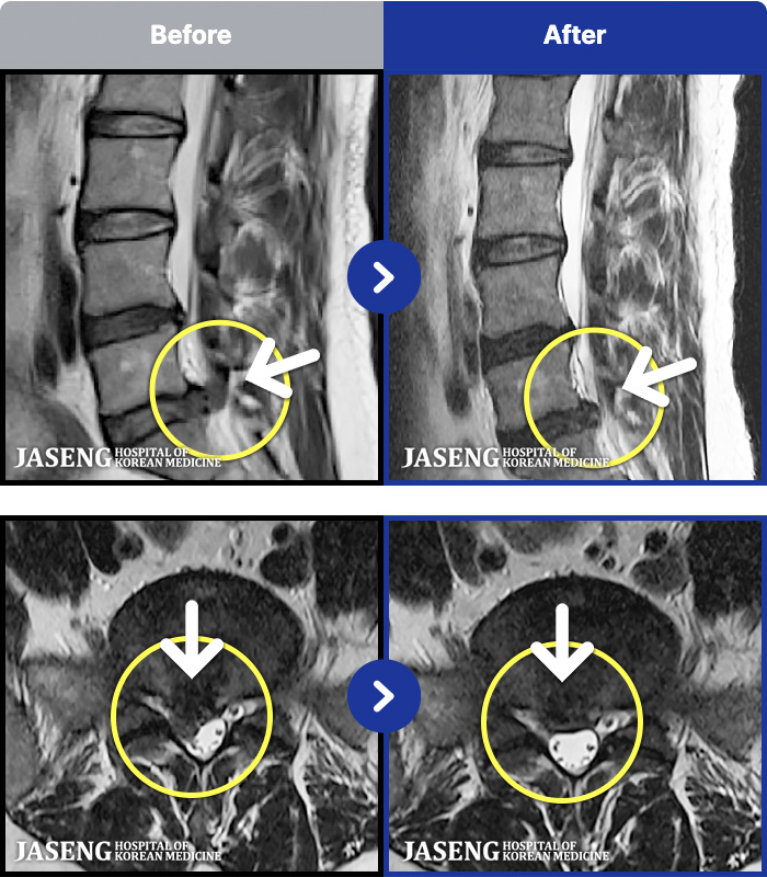 õ���ڻ��ѹ溴�� ġ���� MRI�� ���� ġ����-���� ���� �� ���� �����ĸ�� �� ��ü�� ����, �ٷ�����